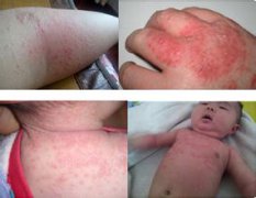 專(zhuān)業(yè)除醛師全方位解讀如何真正去除室內(nèi)甲醛