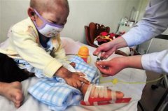 “白血病”兒童增加，甲醛危害值得關(guān)注